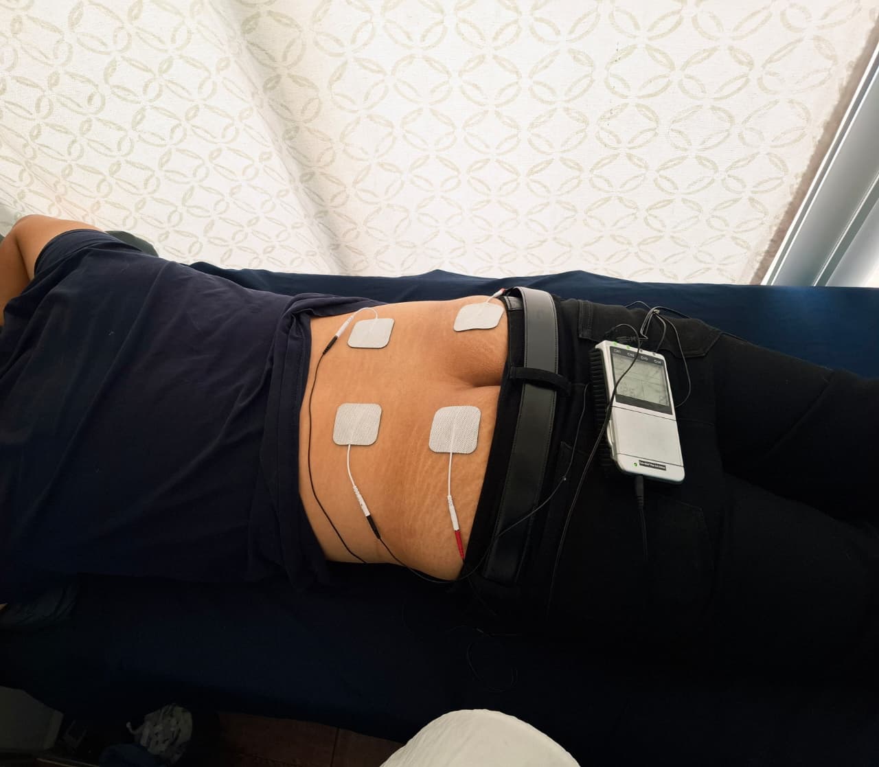 Electroestimulación